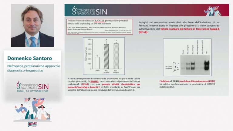 Prof. Domenico Santoro – Nefropatie proteinuriche — Transcript